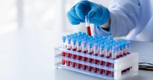 Legnica - Dlaczego warto robić regularne podstawowe badanie krwi?